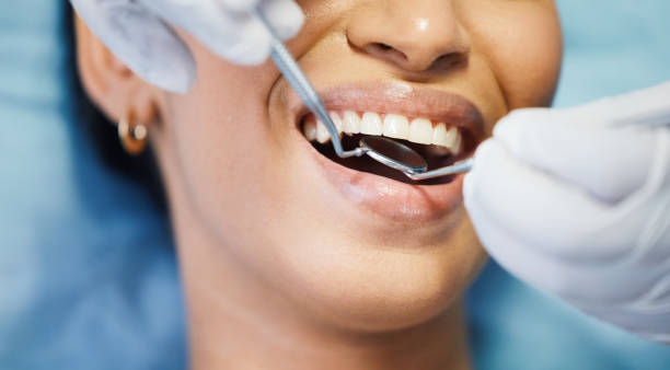 Best Emergency Dental Care for Sports Injuries in North Potomac, MD