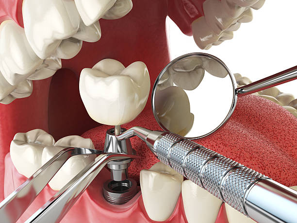 Best 24-Hour Emergency Dental Care in North Potomac, MD