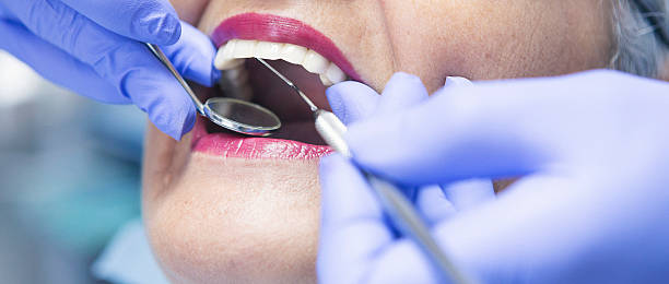 Best Emergency Root Canal Therapy in North Potomac, MD